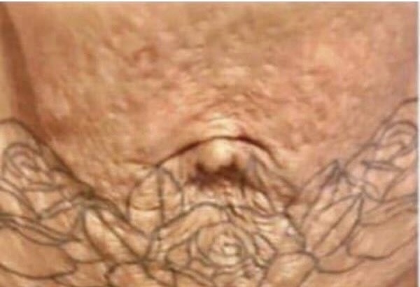 Before using Magic Skin Repair — Aaliyah M.