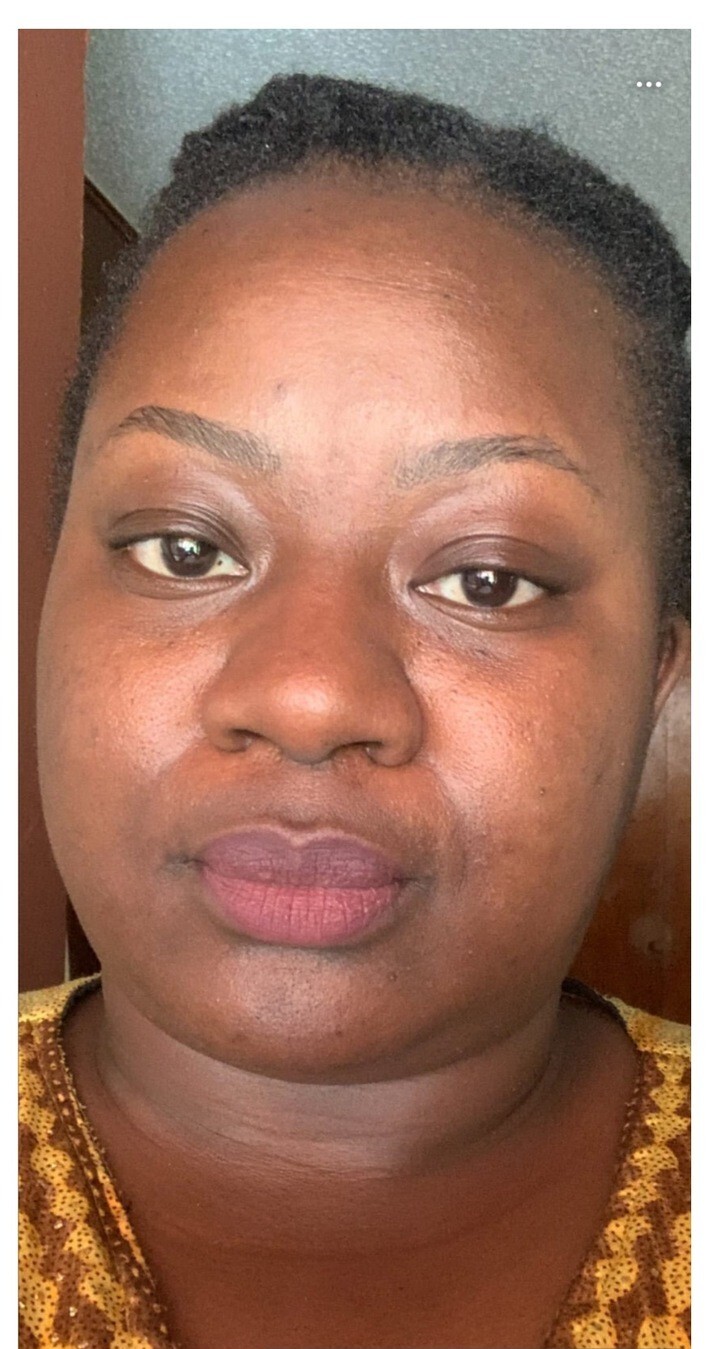 After using Magic Skin Repair — Shekyllah S.