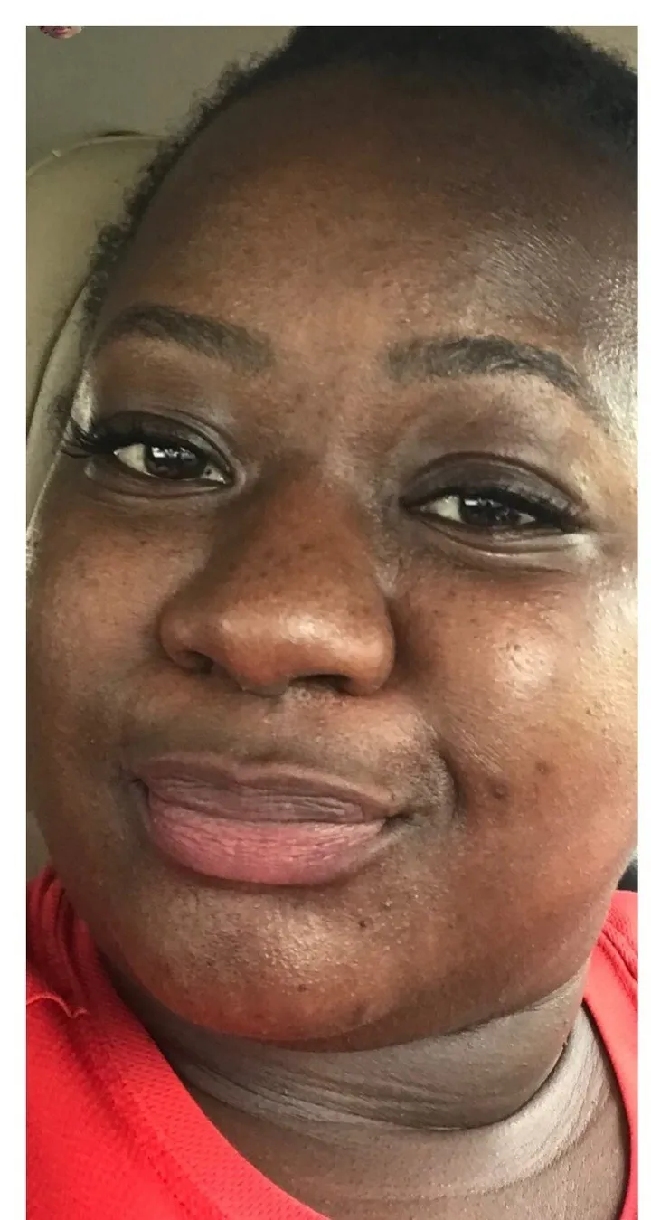 Before using Magic Skin Repair — Shekyllah S.