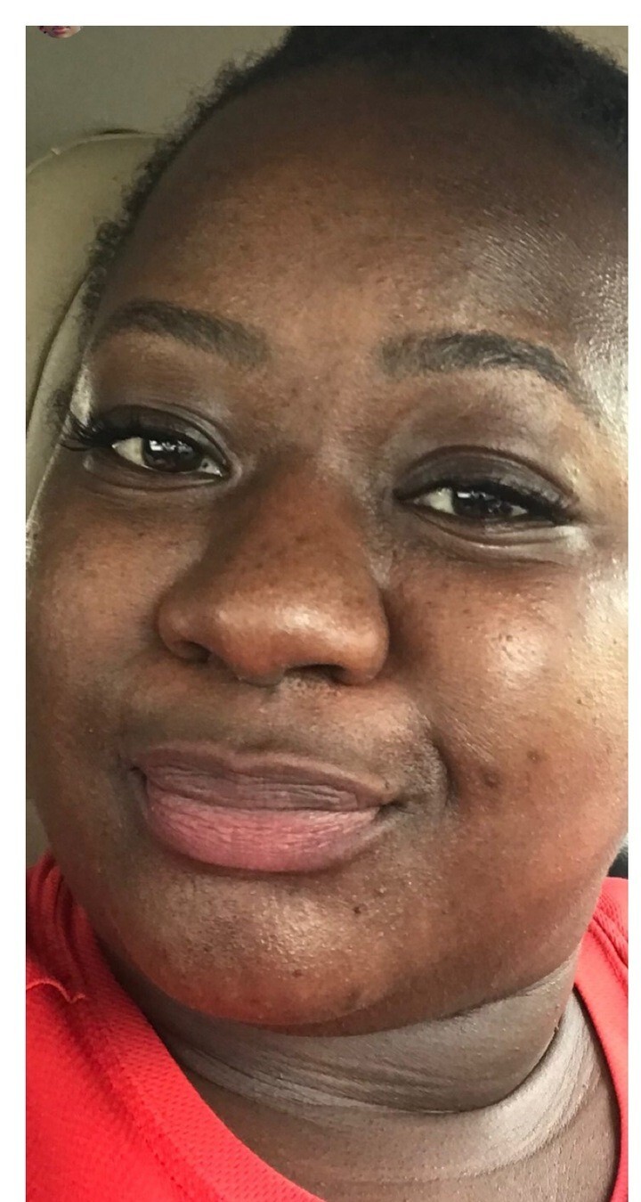 Before using Magic Skin Repair — Shekyllah S.