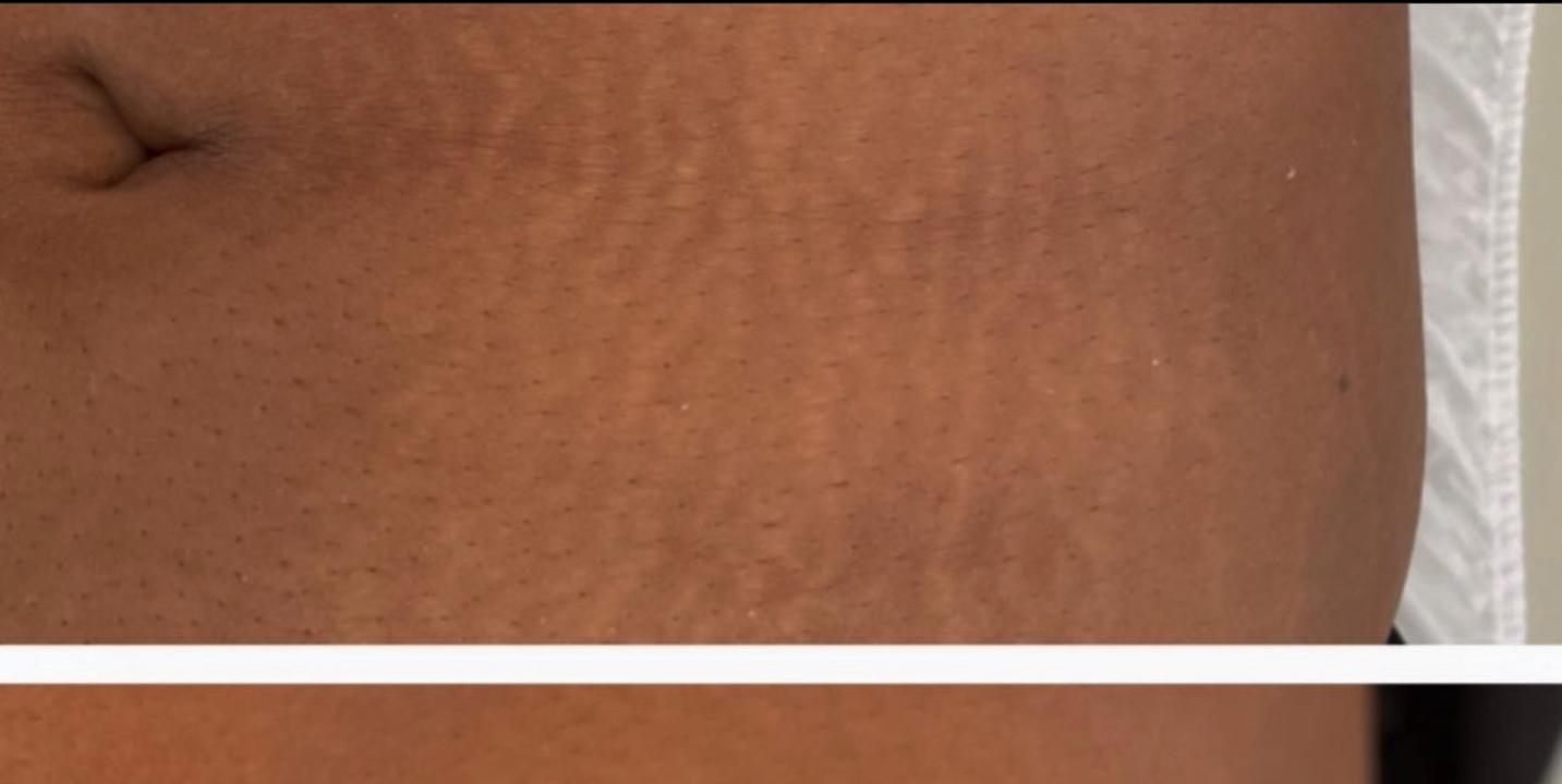 Before using Magic Skin Repair — Jasmine T.