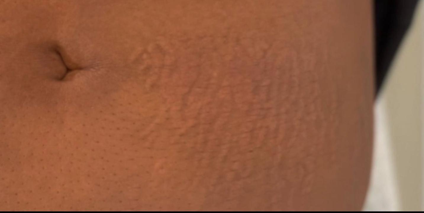 After using Magic Skin Repair — Jasmine T.